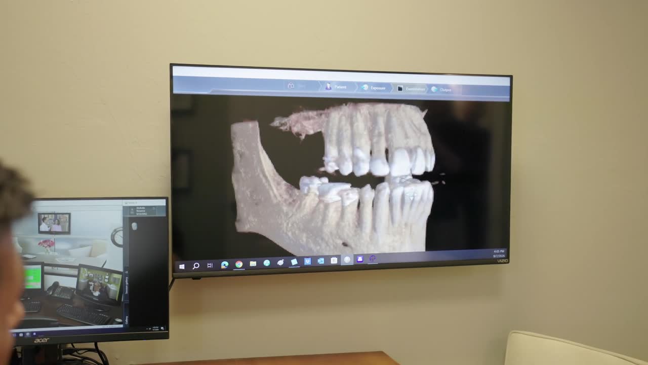 3D dental scan of a patient’s teeth on a wall screen